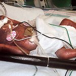 <b>다섯</b>달 반만에 태어난 기적의 볼펜 아기