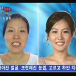 성형의 힘이란... <b>대단</b>하다!