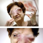 얼굴에 생긴 <b>희귀종</b>양으로 끝내 죽음을 맞이한 어머니..