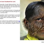 얼굴에 털이 <b>복실</b>복실, 원숭이 소년? 그냥 평범한 소년일 뿐~