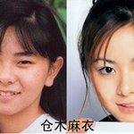 15번의 성형한 <b>일본가수</b> 쿠라키 마이