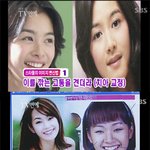 <b>치아</b>교정으로 확 달라진 스타들..정말 <b>치아</b>교정만..?