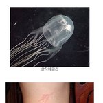 해파리에게 공격 당했을 때는 이렇게 대처하세요!