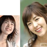 이연희 <b>치아</b>성형 전후 비교