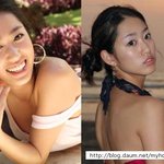 전혜빈 <b>성형전</b>