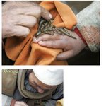 거머리 <b>치료법</b>.. 수천년이나 된 의학이야?