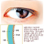 안구건조증 증상과 처방