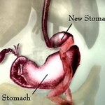 졸지에 날씬해지고 싶으시다구요?