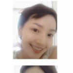 남규리 <b>써클</b>뺀 실제 피부~!!