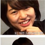 윤은혜, <b>치아</b> 교정좀 했으면 좋겠다