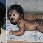 인도의 11살 '<b>늑대</b>소년'