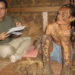 온몸이 나무로 뒤덮인 나무인간~많이 호전 되셨네요!