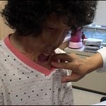 화상으로 피부가 녹아버린 할머니