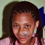 감동의 성형수술..우리에겐 인생이 달려있어요