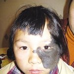 <b>동물</b>의 피부를 가졌던 소녀, 괜찮아 졌어?