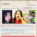 [뒷구멍<b>통신</b>] 성형수술계에 부는 카밍아웃 바람!! "나 성형했어요~...