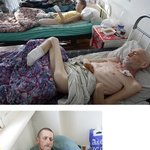 키르기즈스탄의 노숙자들.. <b>동상</b> 때문에 절단을..