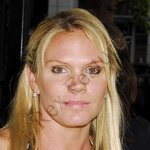 빅토리아베컴 여동생 "루이스<b>아담스</b>"