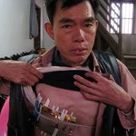 수술비 모자라서 가슴 절개했다가 <b>봉합</b>안해준 의사....대박..