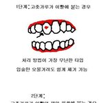 <b>이빨</b>에 고춧가루 꼇을때..