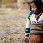 돈 없어서 의족 대신 10세 농구공 소녀