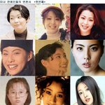 성형해서 <b>무지</b> 성공한 연예인들
