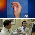 엄지손가락 잃은 <b>목수</b>, 엄지발가락을 이식했어?