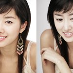 전혜빈 <b>성형</b>인정