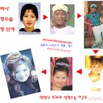 <b>채리</b>성형수술단계변사