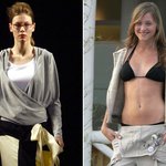 거식증 모델 자매 6개월간 잇따라 돌연사