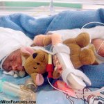 23주만에 450g으로 태어난 아이, 50명분의 <b>수혈</b>받고 살아나다!