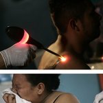 취업을 위해 <b>문신</b>을 제거해야만해