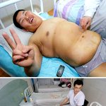 109kg 감량에 성공한 중국<b>소년</b>