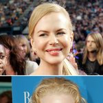 니콜키드먼, 입술이 점점 <b>도톰</b>해져가는...성형??