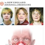 안면이<b>식한</b> 그녀.. 이젠 웃을 수 있어요~