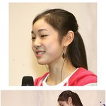 <b>치아</b> 교정기 뺀 김연아, 팬미팅