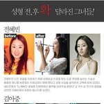 성형 전 후~완전 확 달라진 그녀들~