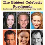 헐리우드 최고의 ‘넓은 이마’스타는?…<b>사라</b> 파커·니콜 키드먼 등...