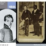 50년간 남자로 살았던 유명 여의사.신원 밝혀져