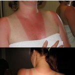 <b>태닝</b>.. 아무리 좋다지만 살이 익었네 익었어!