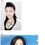 송혜교처럼 성형<b>수술</b>했다는 중국 연예인
