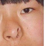 초대박,중국에 콧구멍이 3개인 소녀가 살고있네요...!!