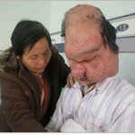 중국의 <b>사자</b>얼굴 남성 양 후이민