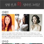 성형 <b>전후</b> 그녀들이 달라&amp;#51275;다,,