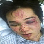 수습기자, 폭행사건 두고 주장 엇갈려