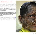 얼굴 전체가 <b>털</b>로 뒤덮힌 소년!!!흑 초금 무섭 ㄷㄷ