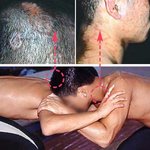 얼굴에 생기는 <b>무좀</b>