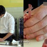 '데니스 오, 손이 왜 저렇게 늙었어?