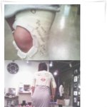 황신혜, 다리 골절· <b>전치</b> 8주!! 깁스한 모습도 이쁘네~