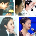 [김태희 이마뽕] 사실이야...진짜야??? <b>이마이</b>뿌닷 +.+